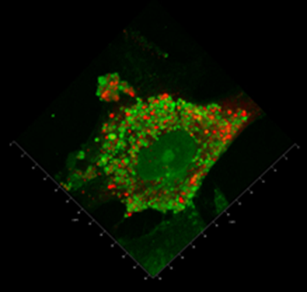 An innovative treatment for Duchenne muscular dystrophy