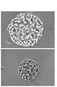 Metformin, a diabetes drug