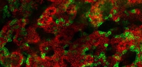 Neonatal testis orgnaoids_Sertoli cells_germ cells