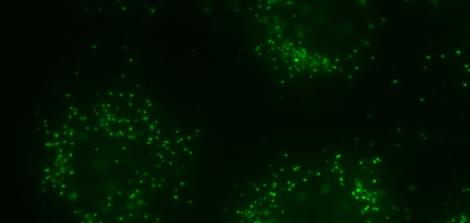 Peroxisome in rat neonatal cardiomyocyte