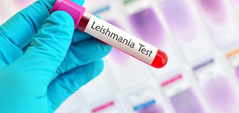 Vacutainer with Leishmania Test sticker