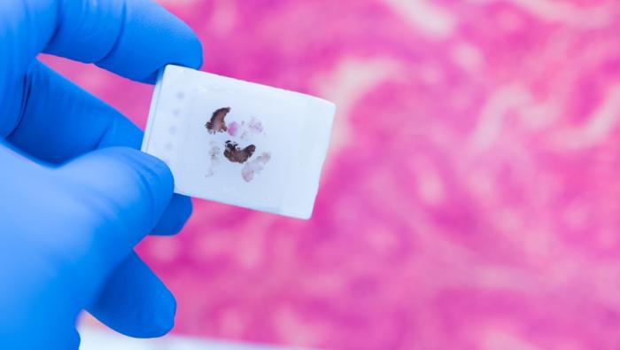 glove holding stained tissue