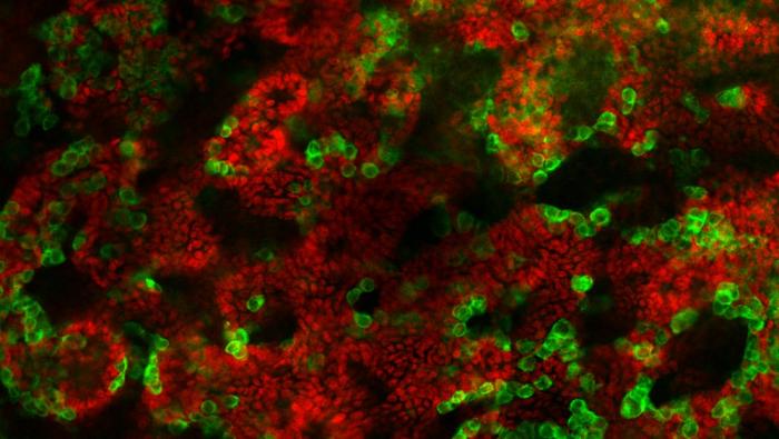 Neonatal testis orgnaoids_Sertoli cells_germ cells