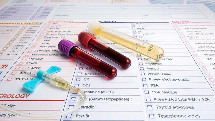 blood samples on sheet with checkboxes