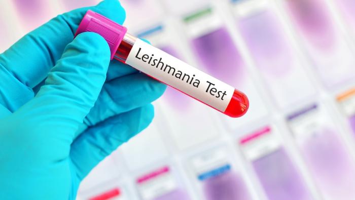 Vacutainer with Leishmania Test sticker